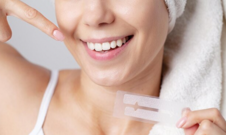 should you brush your teeth after whitening strips